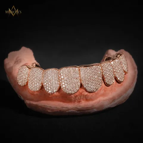 Dynast's Pavé Grillz — detail 4