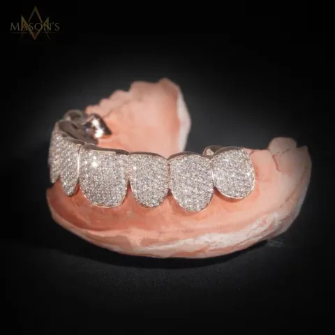Dynast's Pavé Grillz — detail 1