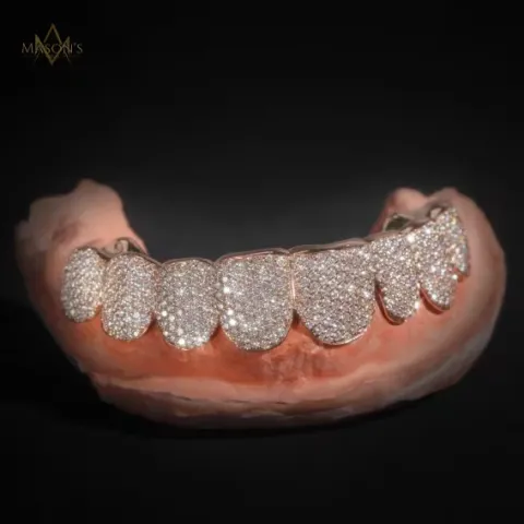 Dynast's Pavé Grillz — detail 2