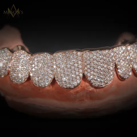 Dynast's Pavé Grillz