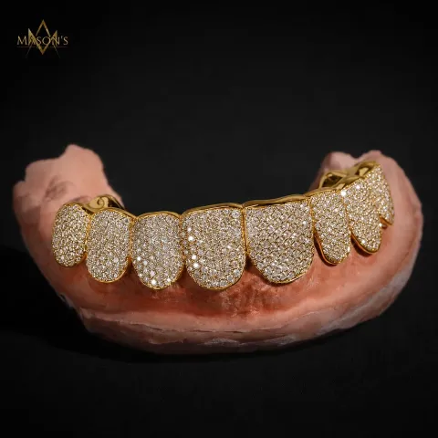 Dynast's Pavé Grillz — detail 3