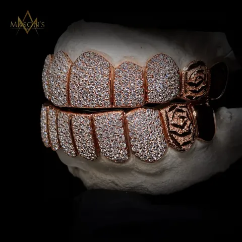 Hexarch's Rose Grillz — detail 6