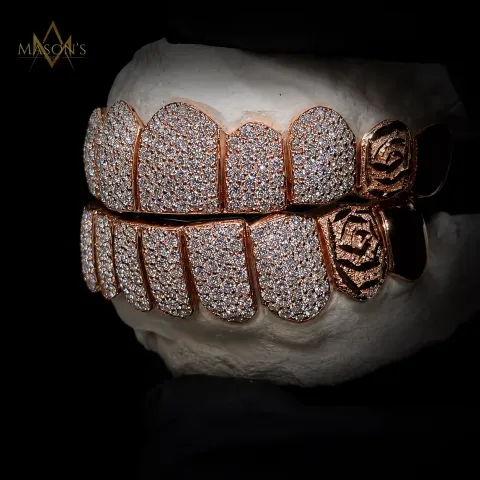 Hexarch's Rose Grillz — detail 3