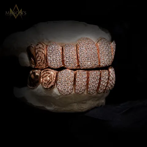 Hexarch's Rose Grillz — detail 1