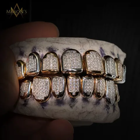 Orbis' Pavé Grillz